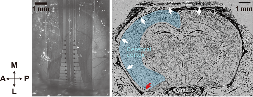 Placement of the developed electrocorticography device on the mouse brain surface. Left: Photo of the electrode array placed from the parietal region to the temporal region (device inserted into an even deeper region of the cortex). Right: Photo of the device placed on the brain and brain surface  (white arrow = device, red arrow = device tip).