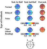 Figure2 : Topological plots of ERD/ERS during simulated vocalizations with normal feedback, delayed feedback, and noise feedback, and silent reading.