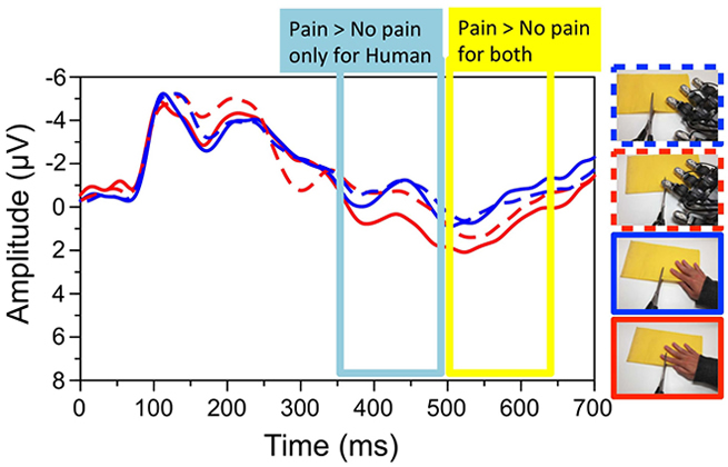 Averaged ERP at Fz (frontal region) for pain and  non-pain stimuli