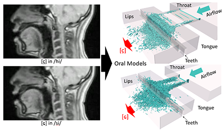 Numerical simulations of the speech productions of /hi/ and /si/.　Observation on the real-time MRI and flow vortices in the oral models.