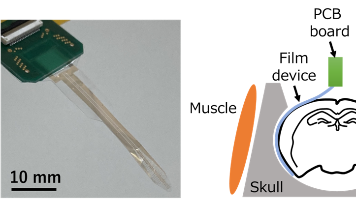 Photo of the developed multichannel electrocorticography device (left). Schematic diagram of the electrocorticography method for a wide area of the brain using the developed device (right).